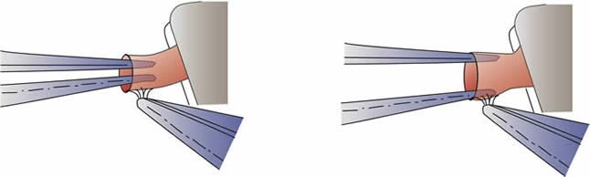 Vessels_dilators_1413277122